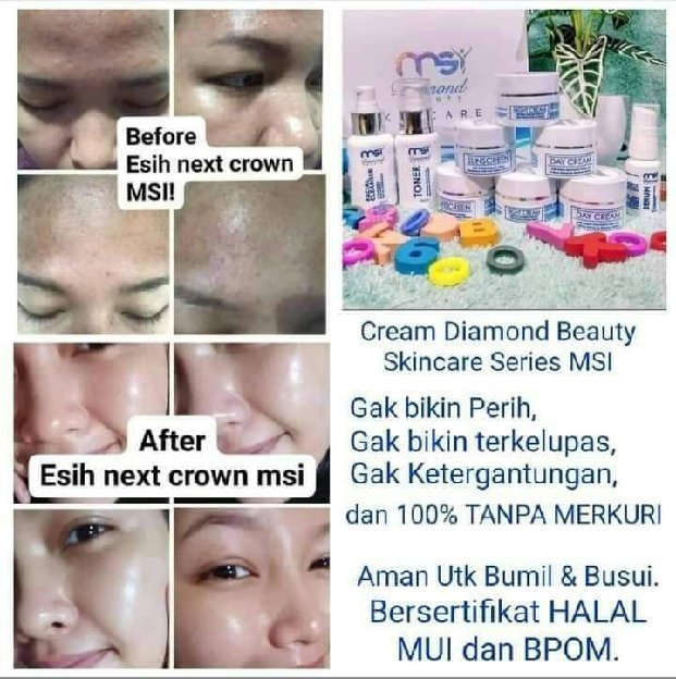 MSI DIAMOND BEAUTY SKINCARE 