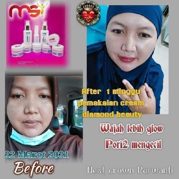 MSI DIAMOND BEAUTY SKINCARE 