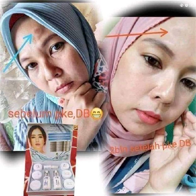 MSI DIAMOND BEAUTY SKINCARE 