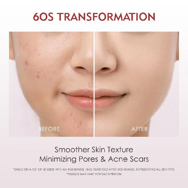 ELFORMULA Intensive Peeling Solution - Peeling Serum Dark Spot Glass Skin Eksfoliasi Wajah Mengangka