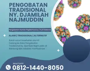 Hilangkan Kutil Kelamin Dengan Pengobatan Alami Ny. Djamilah Najmuddin